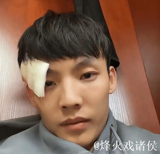 广东迎伤病潮!徐杰眉骨开裂杜润旺肩部撕裂,两新援至今一场没打 广东迎伤病潮!徐杰眉骨开裂杜润旺肩部撕裂,两新援至今一场没打